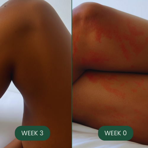 Gl1DE™ - The Friction Bar